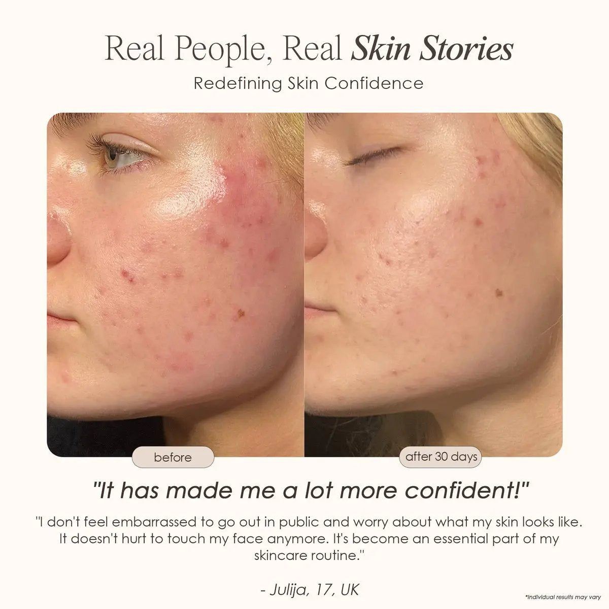 Novaskin LED Face Mask | SkynGlowUp SkynGlowUp