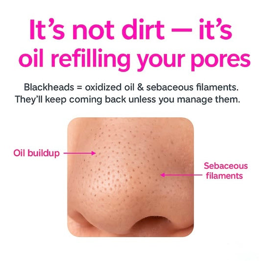 PoreLift™ | SkynGlowUp SkynGlowUp