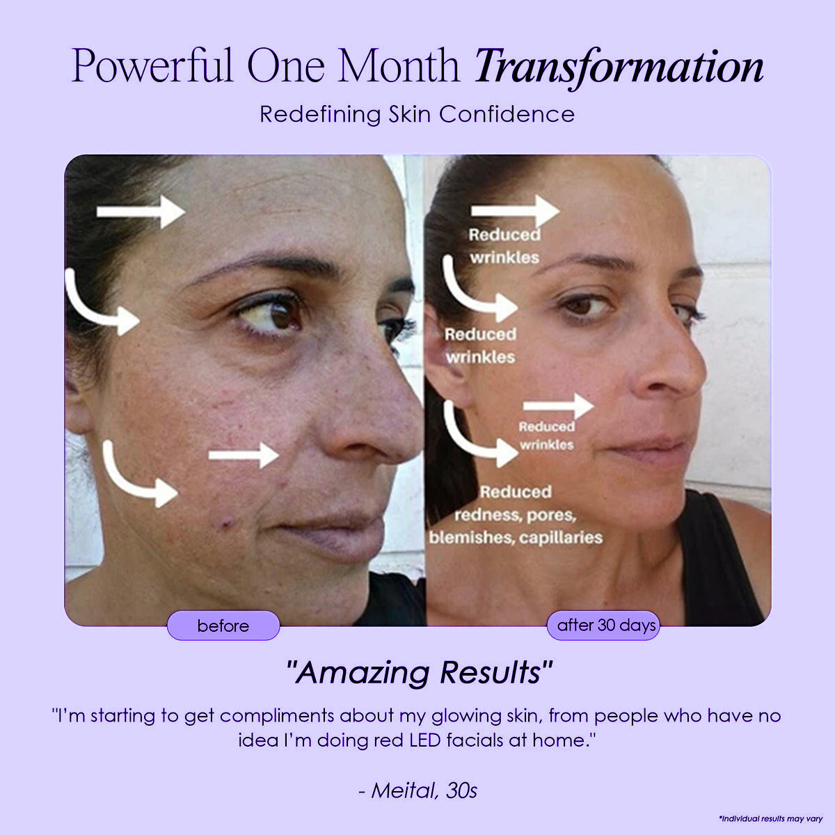 Novaskin LED Face Mask | SkynGlowUp SkynGlowUp