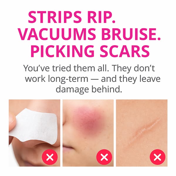 PoreLift™ | SkynGlowUp SkynGlowUp